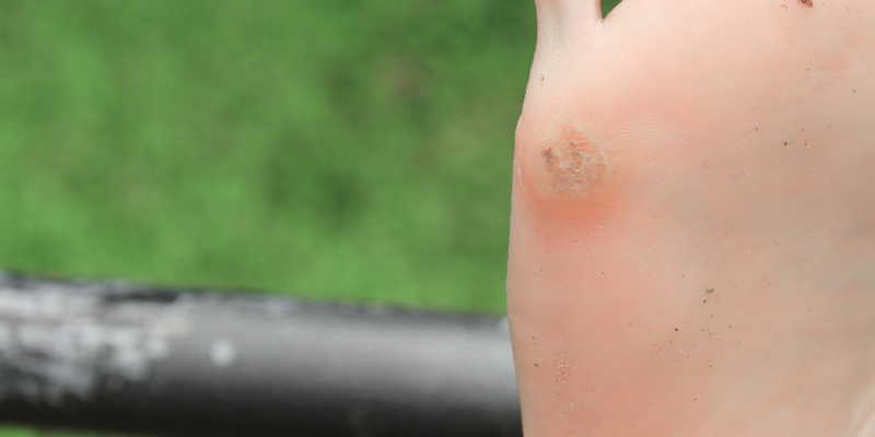 Kurie Oka Preco Vznikaju A Ako Sa Ich Zbavit Najlekaren Eu