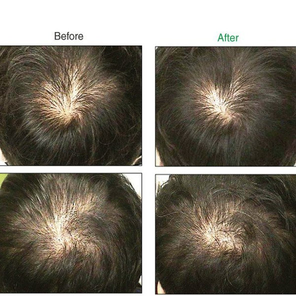 PELO BAUM Sérum proti vypadávaniu vlasov 60 ml