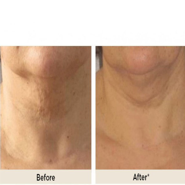 ENDOR Neck & Décolleté krém na krk a dekolt 60ml