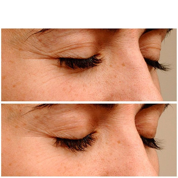 ENDOR Anti-aging Eye Contour krém na očné okolie 15ml