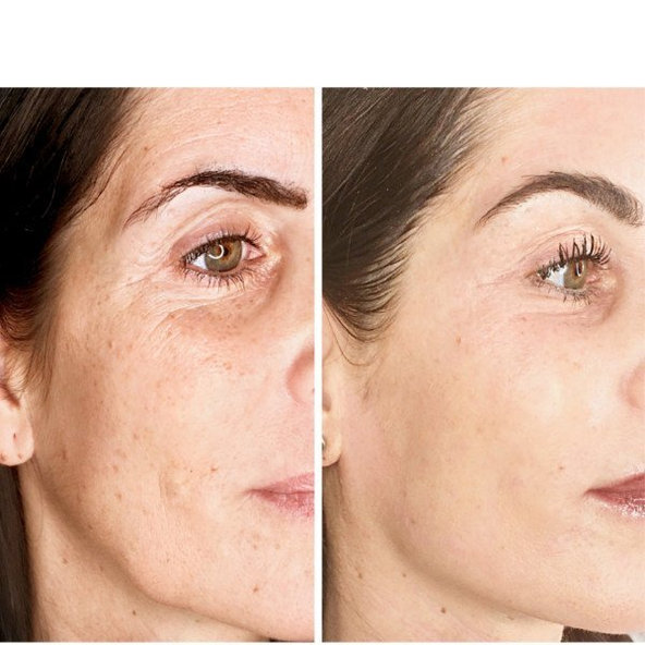 Dermaheal Sun Screen SPF 50+ opaľovací krém 50g