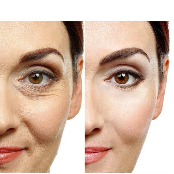 ENDOR Anti-aging Nutritive výživný omladzujúci krém SPF25 60ml