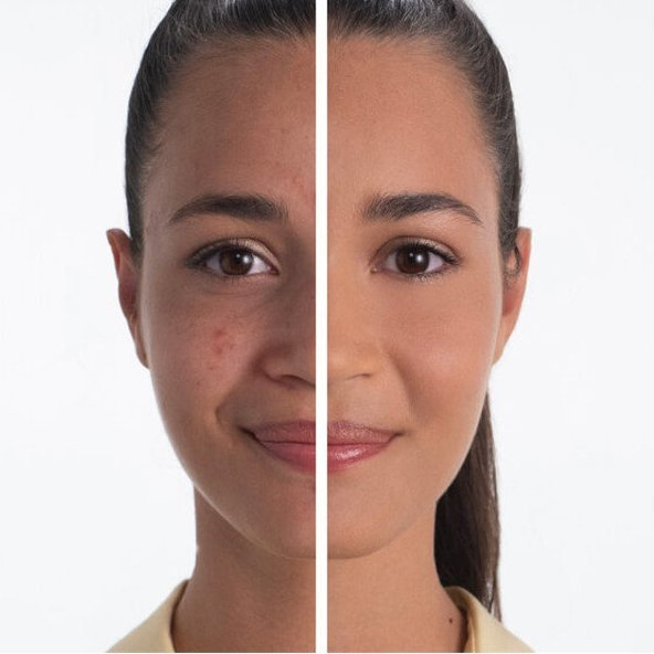 Dermaheal CC – odtieň Tan Beige (svetlohnedý odtieň) 50g