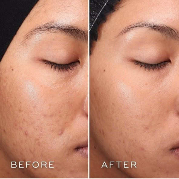 Medik8 Press & Clear exfoliačné tonikum 150ml