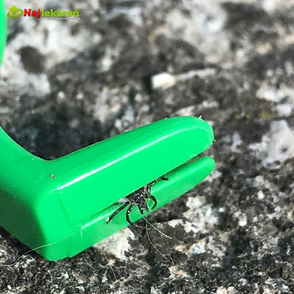 Háčiky na vyberanie kliešťov  2ks