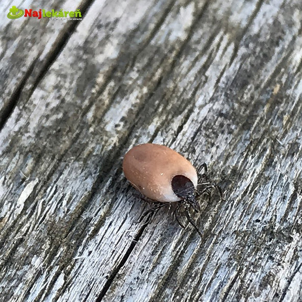 Háčiky na vyberanie kliešťov  2ks