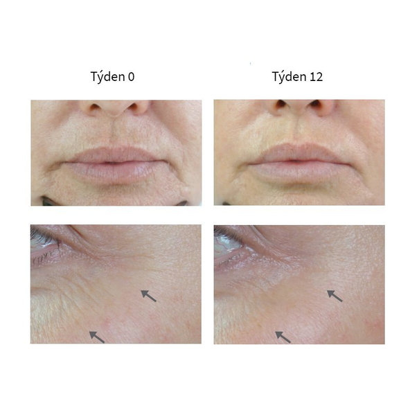 Medik8 r-Retinoate Day & Night krém aktivujúci mladosť 50ml