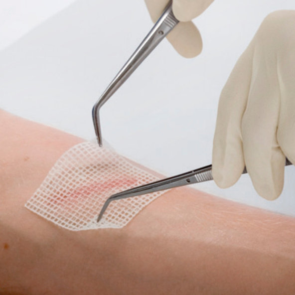 LEUKOPLAST Cuticell Classic sterilné krytie 5x5 cm, 5 ks