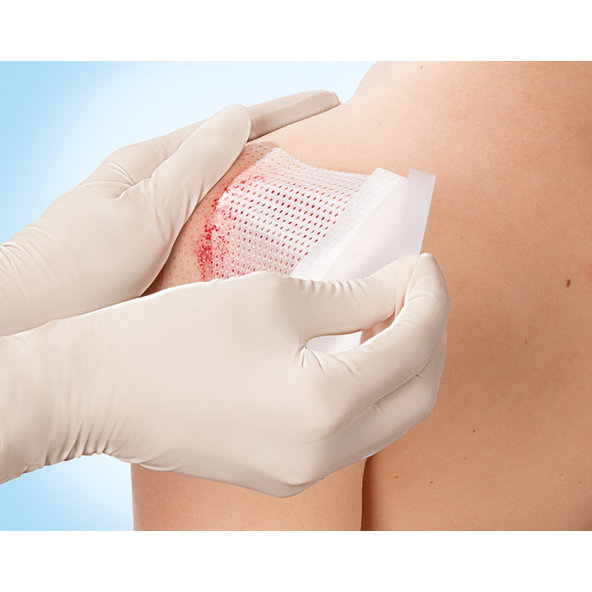 LEUKOPLAST Cuticell Contact sterilné krytie 5×7,5 cm, 5 ks