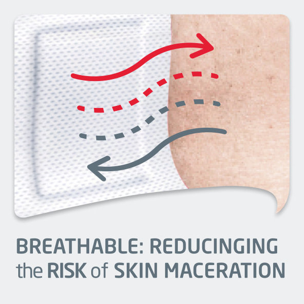 LEUKOPLAST Soft White náplasť na rany 38 x 72mm, 10ks