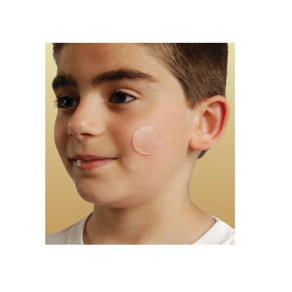 NewGel+ Priehľadná bodová náplasť (6 ks) NG-380