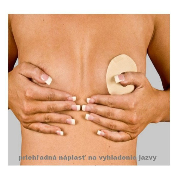 NewGel+ Kruhová priehľadná náplasť  (2 ks) NG-320