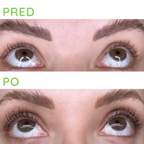 Simply You Mihalnicové hnojivo SÉRUM 3ml