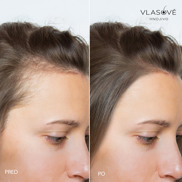 Vlasové hnojivo proti vypádavaniu vlasov 60tbl