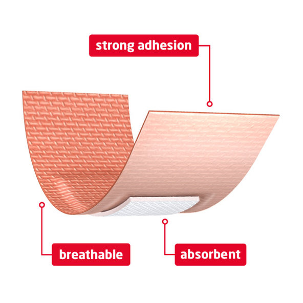 LEUKOPLAST strong 2 veľkosti 20ks