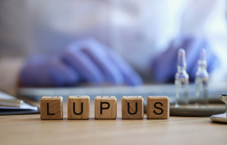 Kocky so slovom LUPUS symbolizujúce autoimunitné ochorenie – je lupus smrteľný?