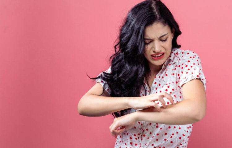 Žena si škrabe ruku v dôsledku kožnej reakcie na alergiu