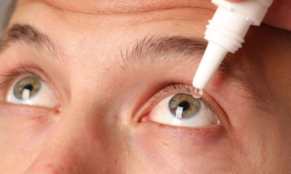  Detail oka, do ktorého si človek aplikuje očné kvapky, znázorňuje suché oči, podráždenie spojiviek a potrebu hydratácie pri syndróme suchého oka a únave očí.