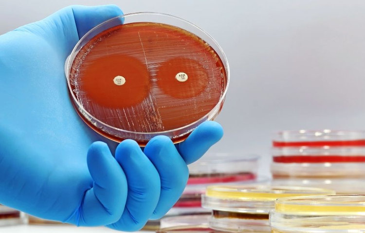 Testovanie zlatého stafylokoka – Petriho miska s kultúrou a testovacími diskomi v ruke laboranta.