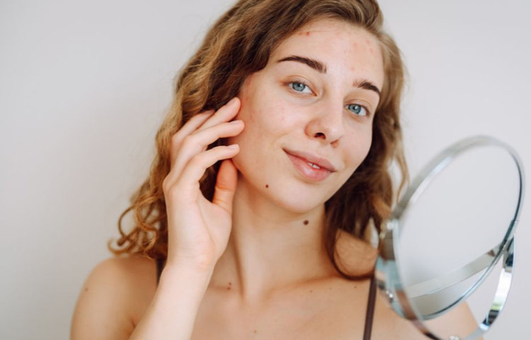 Jarné alergie a citlivá pleť. Ako ju upokojiť a správne ošetrovať?