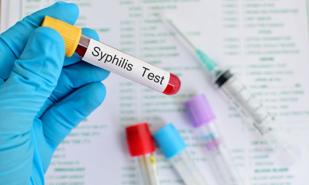Syfilis test