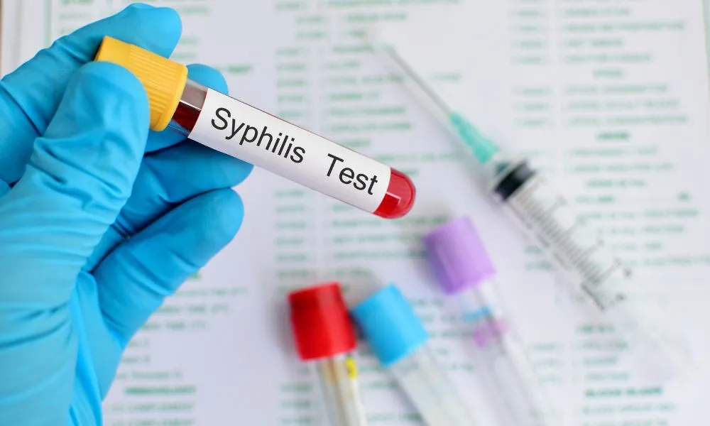 Syfilis test