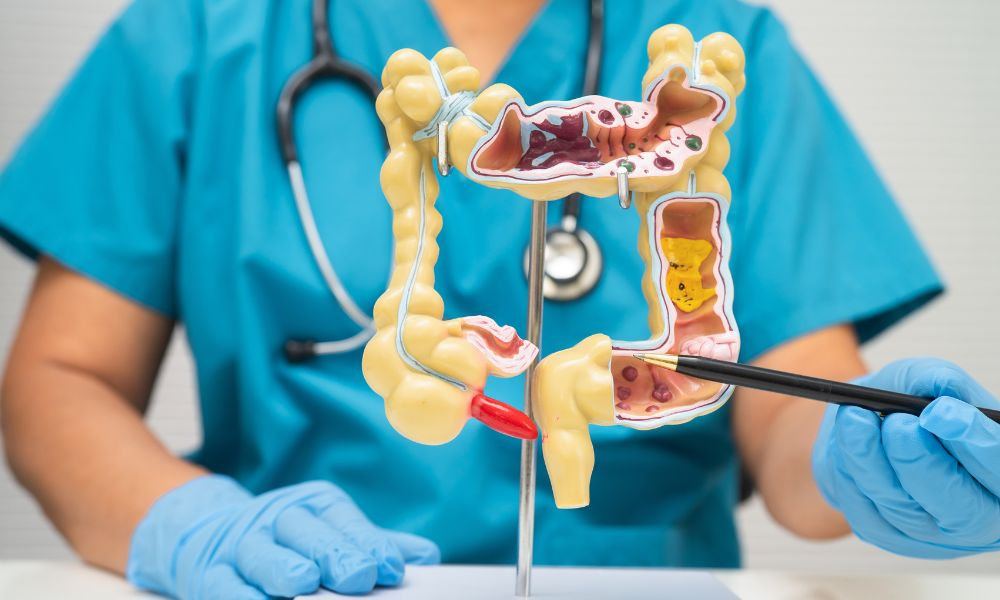  Lekárka v tyrkysovom plášti a modrých rukaviciach drží anatomický model hrubého čreva a ukazuje ceruzkou na jeho jednotlivé časti, vysvetľujúca význam laktobacilov v tehotenstve a zdraví čriev.