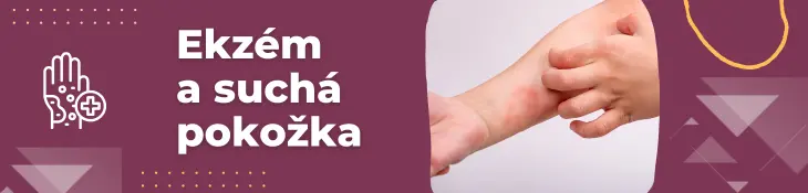 Krémy na ekzém a suchú svrbivú pokožku